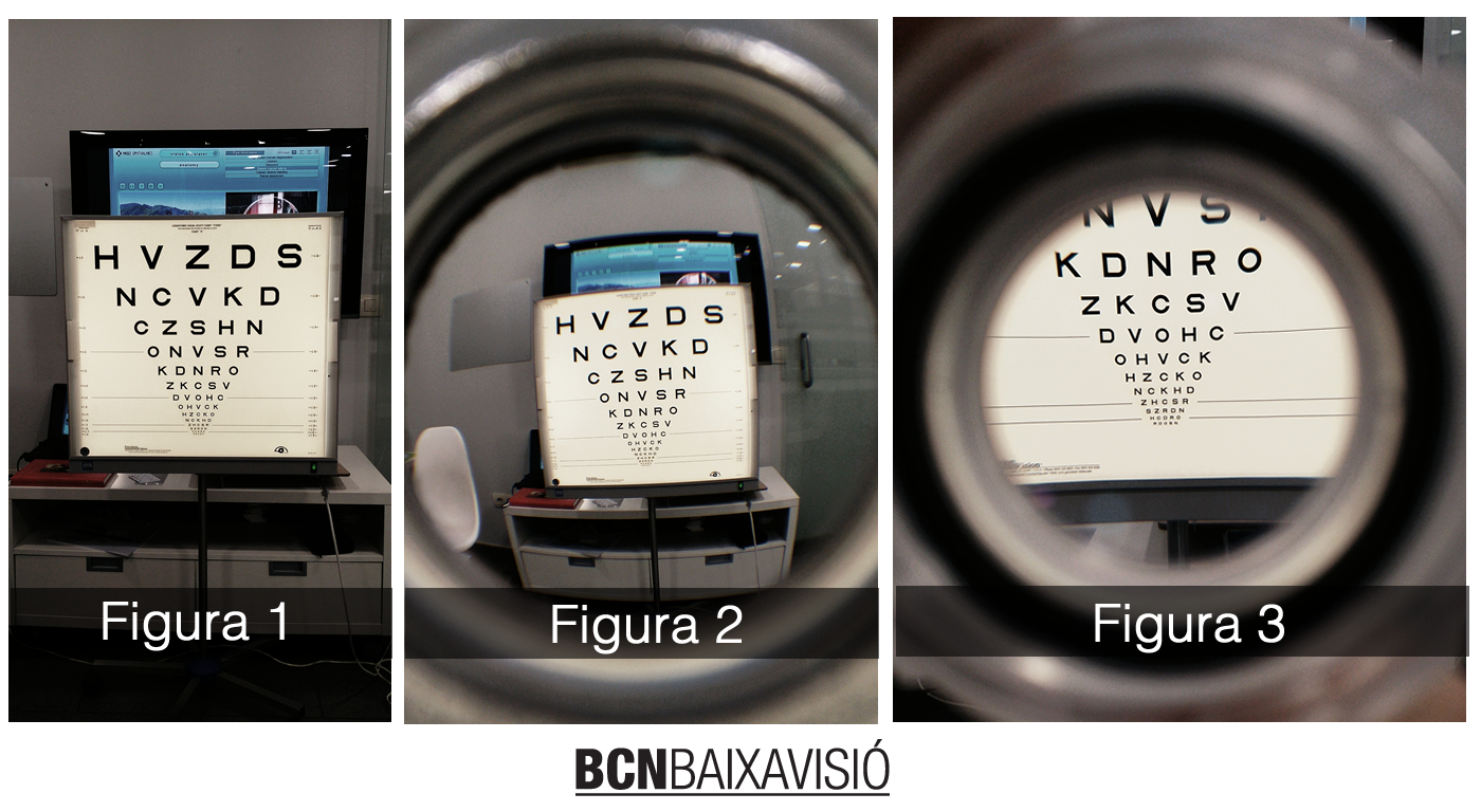 Aumento para pacientes con baja visión